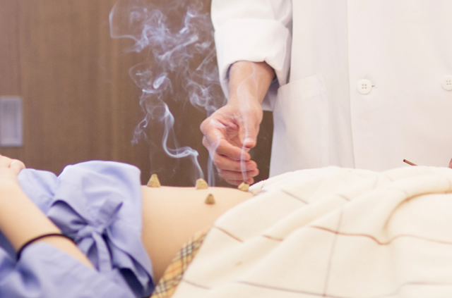 痛くないはり・心地よいお灸